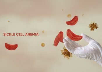 Nigeria accounts for over 1.5 million children with sickle cell disease, highest in the world, new Lancet study shows